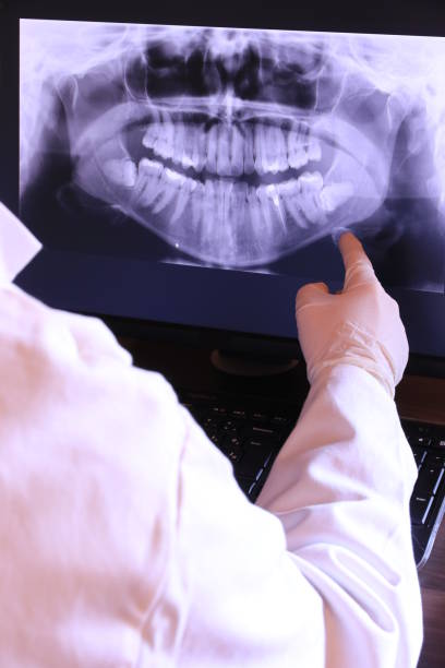 Best Emergency Denture Repair in Ventnor City, NJ